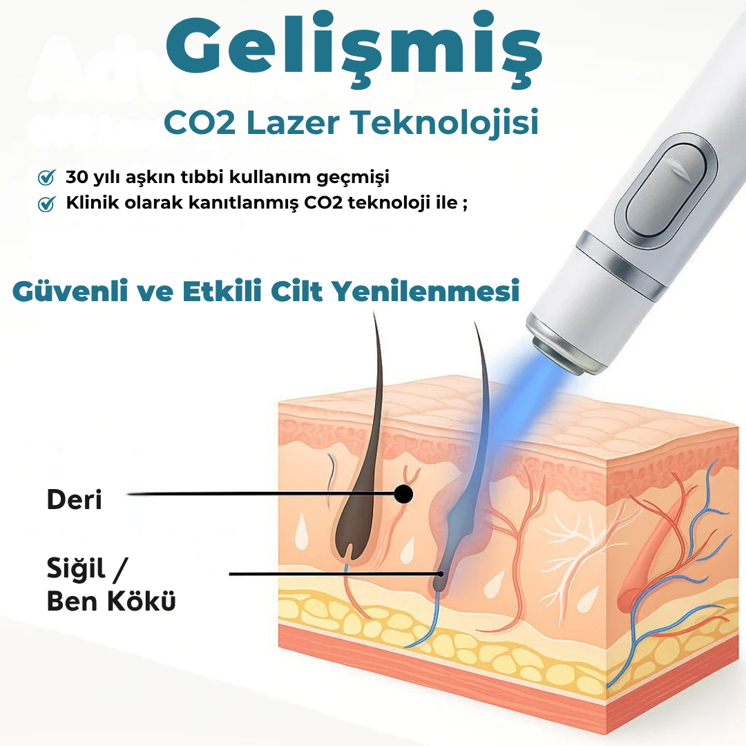 Siğilsavar™ MediSkin Lazer - Ameliyatsız Siğil ve Ben Çözümü