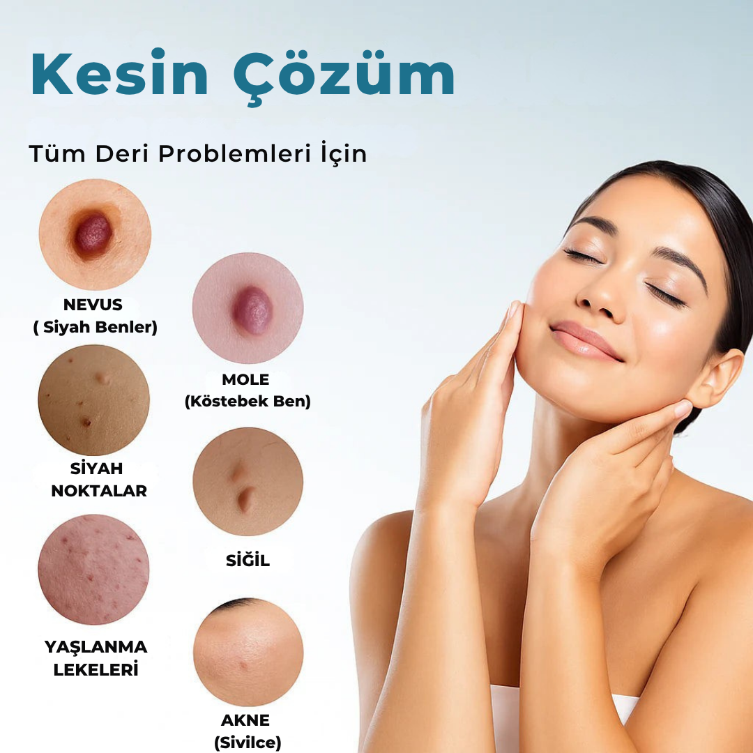 Siğilsavar™ MediSkin Lazer - Ameliyatsız Siğil ve Ben Çözümü
