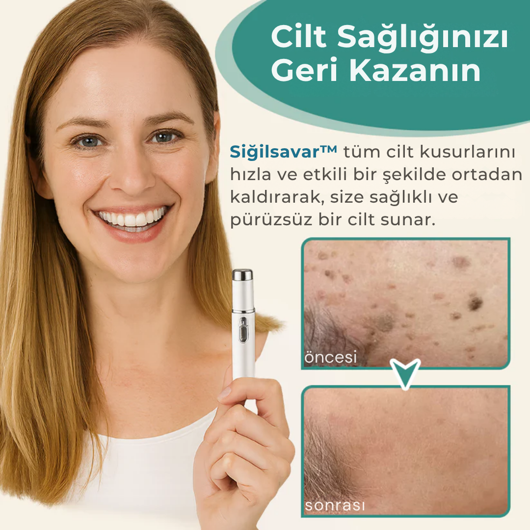 Siğilsavar™ MediSkin Lazer - Ameliyatsız Siğil ve Ben Çözümü