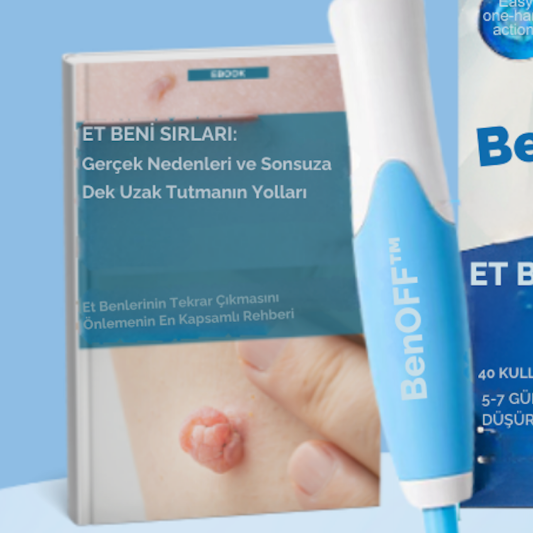 Et Beni Sırları ( E-Kitap )