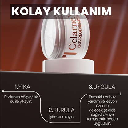 CelarneX- Genital Siğil Kremi