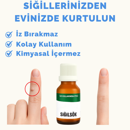 SiğilSök - Bitkisel Siğil Giderici Solüsyon