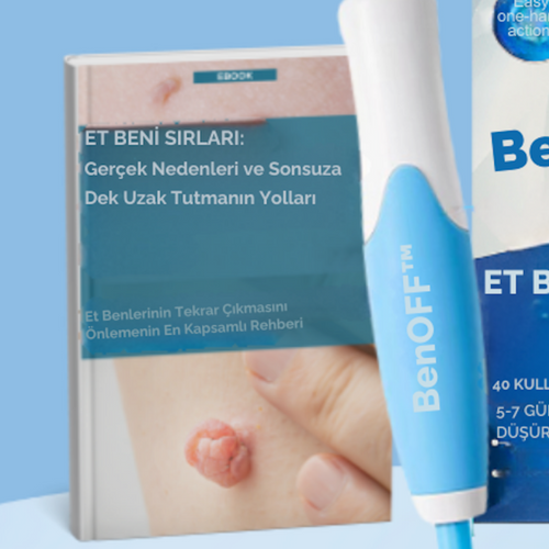 Et Beni Sırları ( E-Kitap )